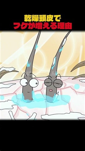 乾燥頭皮でフケが増える理由