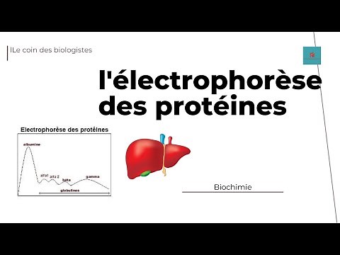 Understanding and interpreting protein electrophoresis
