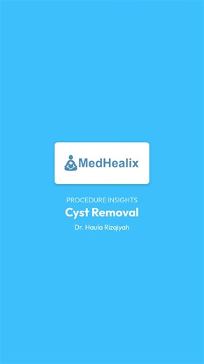 Cyst Removal - Procedure Insights