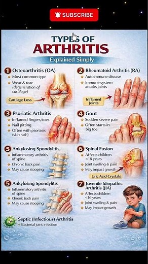 Arthritis Explained Simply: Understanding the Different Types