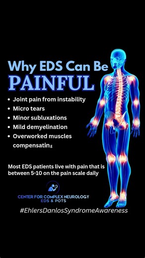 Why EDS Can Be Painful - #shorts
