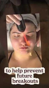 Why do we use High Frequency after extraction facials? #highfrequency