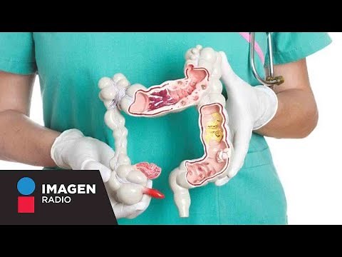Todo lo que necesitas saber sobre la colonoscopia | Bien y Saludable