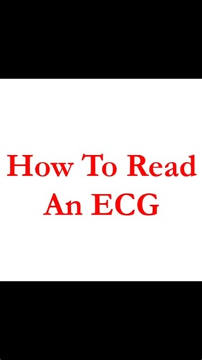 Ankit Kumar on Instagram: "How to read ECG"