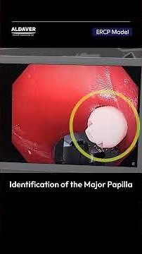ERCP Procedure Simulation | From Gastric Entry to Fluoroscopic Confirmation