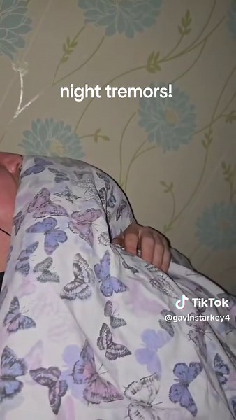 Functional Neurological Disorder (FND) can cause tremors, including at night. These tremors are involuntary and can vary in severity and location. While the exact cause of FND is not fully understood, it's believed to involve the nervous system not functioning as expected, leading to various neurological symptoms like tremors. These tremors can be a significant source of distress and can be exacerbated by stress and fatigue. #understanding #united #fnd #fyp #suffering #community #lost