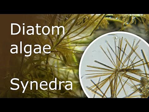 All About Diatom Algae Synedra in the Aquarium: Description, Causes and How to Get Rid of It