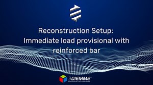 CAD - Reconstruction setup: Immediate load provisional (ENG)