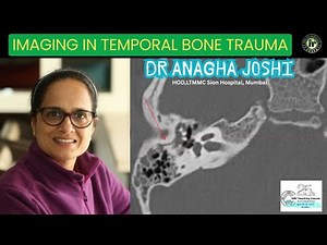 Dr Anagha Joshi | Fractures of the Temporal Bone | HRCT Temporal Bone