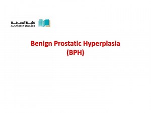 Benign Prostatic Hyperplasia (BPH) - SlideServe