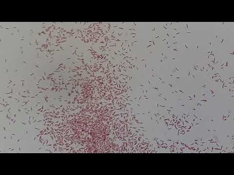 Gram Negative Rods/ Bacilli of Pseudomonas aeruginosa Microscopy