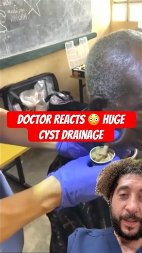 Doctor Reacts: Massive Cyst Drainage 😳 (Filled with Debris)
