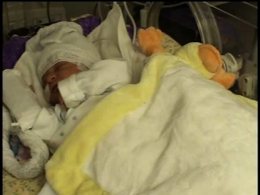 Myoclonus - Neonatal Seizures - Neurology - NeoReviews Video Library