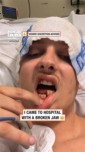 This is what happens when you break your jaw in half 😳 | FOODbible