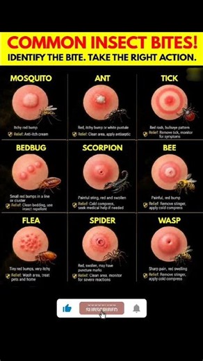 How to Identify Bug Bites & Best Relief Treatments | Common Insect Bites Guide