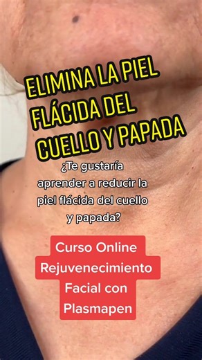Elimina la piel flácida del cuello y papada sin cirugía #fibroblast #plasmapen #fibroblastplasmapen #fibroplastplasma #plasmafibroblast #sinarrugas #pielflacida #sincirugia #cuello #papada #sinpapada #adiosarrugas #esteticistas #tiktokusa #tiktokmexico #reducelíneasdeexpresion #rejuvenecimientofacial