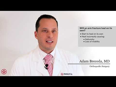 Will an arm fracture heal on its own?
