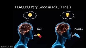 Primary Care Management of Chronic Liver Disease