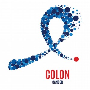 5 Things To Know About Colon Cancer Prevention and Screening