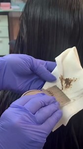 My Hair Helpers Deluxe Family-Size Head Louse Treatment Kit Includes Nit Comb, Mousse, Mint Lice Prevention Shampoo and Conditioner, Spray, and Dimethicone Oil, Works on 2-4 Kids