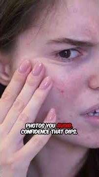 LED Light Therapy Powerful Fast Relief for Active Breakouts Proven Blue+Red