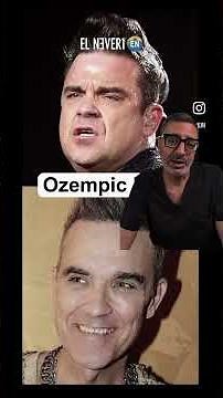 Ozempic Face" Explained