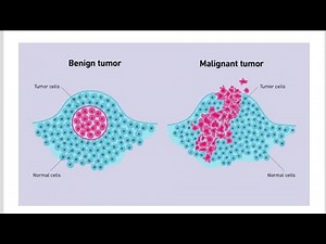 5 essential Alterations Significant for malignant Transformation in a Tissue or cell
