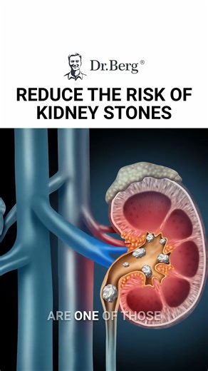 GUARD AGAINST KIDNEY STONES WITH 3 EASY STEPS! 💧💪 Prevent kidney stones before they start! Follow these three simple steps for better kidney health and lasting relief. #kidneystones #kidneyhealth #healthtips #hydration #wellness #proactivehealth #naturalremedies #healthylifestyle #preventivemeasures #holisticcare | Diet & healthy By Dr