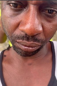 Hit counter on Reels