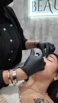 First time getting nose Botox 😳 I was nervous… but kinda obsessed 👀 #nosebotox #botoxresults