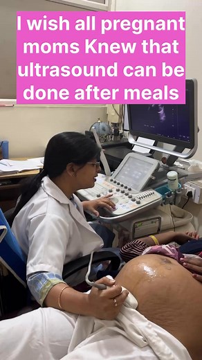 5.4M views · 18K reactions | Pregnancy preparation #babyonultrasound #pregnancyjourney #pregnancyultrasound #pregnancyultrasound #ultrasoundinpregnancy | Dr home - Dr shikha Agarwal | Facebook