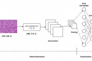 Brain Tumor Histology Algorithm