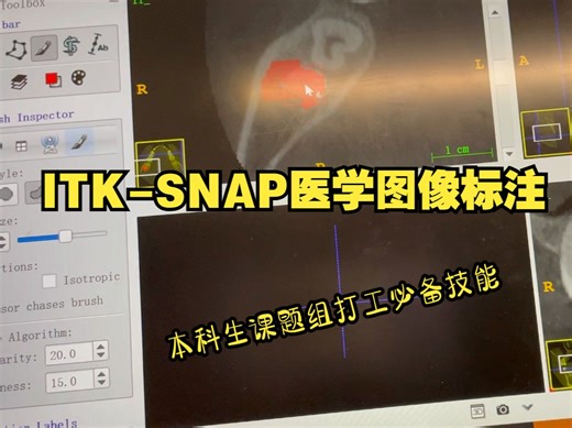 医学图像分割ITK-SNAP软件标注教学