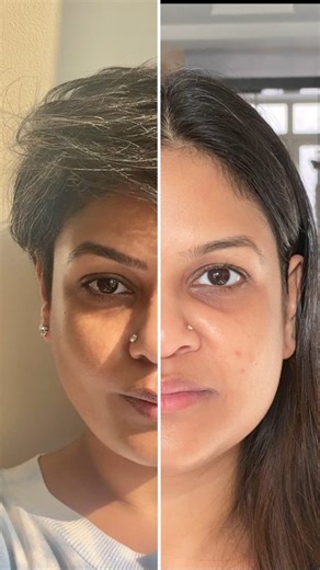 Garima✨India's First Facial Reflexology x Face Yoga Expert on Instagram: "“Garima, how did you go from an overworked corporate employee to someone teaching women how to glow & feel confident naturally?” I get asked this all the time. Here's my story ⬇️ I was that girl stuck in endless deadlines, high stress, and zero time for myself. My skin showed it first, puffiness, pigmentation, stress lines, constant breakouts. I thought expensive facials and 10-step routines were the answer. Spoiler: they 