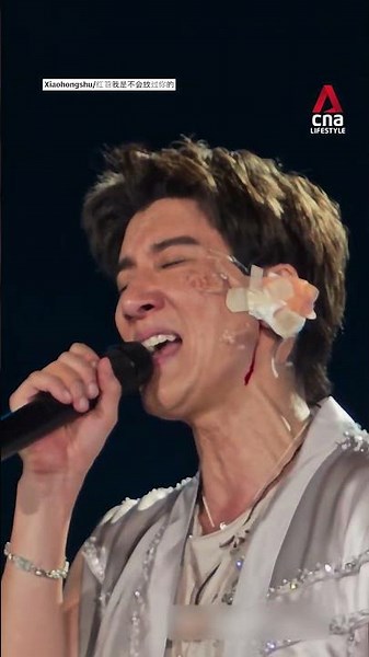 Mandopop star Wang Leehom injured in concert fall, gets 39 stitches