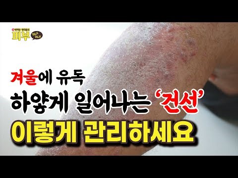 겨울만 되면 피부가 하얗게 일어나는 이유? 겨울철 건선 관리법 - 박치영, 정대웅의 피부 톡톡 #210