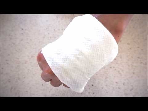 How to REMOVE NEW & OLD SCARS in 2 WEEKS | Naturally get RID of SCARS FAST | Muskaan Hamad