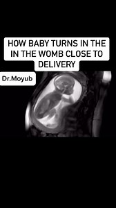 How a baby turns its head down during pregnancy. #baby #pregnancy | Dr.Moyub Healthcare