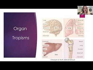 MBC Impact Series: Bone Metastasis Overview and Potential Treatments
