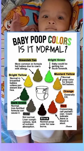 Baby poop colors..Is it Normal? #parenting #guidelines #awareness Acrixa Balino | Momshie Jhane Alcos