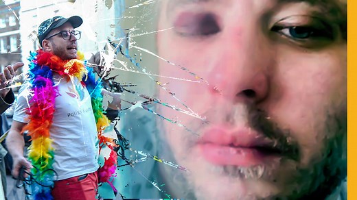 Homophobic hate crime: Beaten-up for being gay