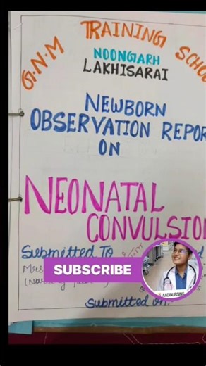 Newborn Observation on Neonatal Convulsion #neonatal_seizure#neonatal_convulsions#pedriatics#newborn