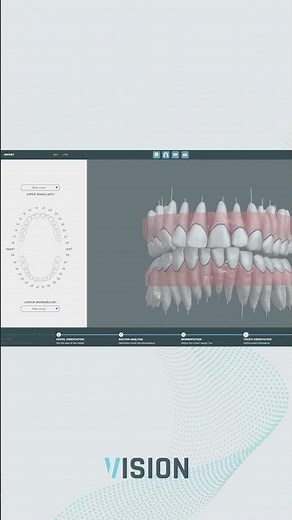 Dental CBCT Scan