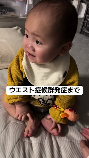 ウエスト症候群の子供のリハビリ体験談と成長過程