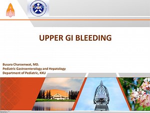 UPPER GI BLEEDING - SlideServe