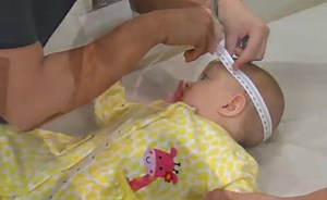 Head Circumference in Pediatrics for Physical