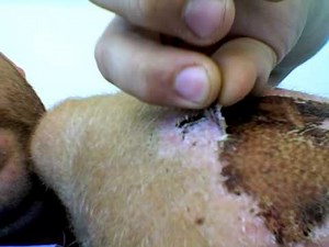 FSG Stuff - Pulling off my scab