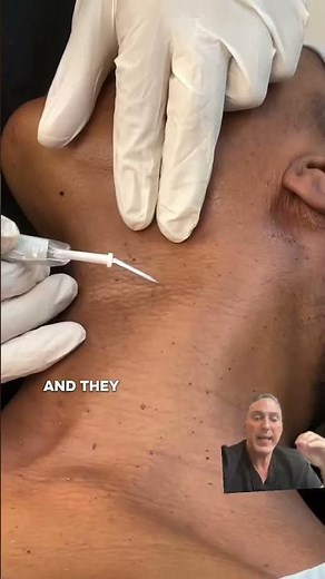 Best Treatment to Remove DPNs