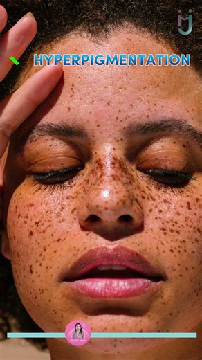 1 Products For 8 skin problem