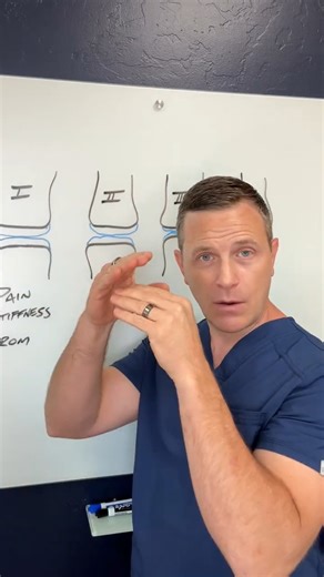 X-ray or MRI — which one is better for diagnosing knee arthritis? 🦵 The answer might surprise you 👇 ✔ X-rays show joint space narrowing, alignment issues, and cartilage loss ✔ MRIs go deeper, revealing cartilage quality and whether damage is partial or full-thickness Understanding which imaging to use — and when can make a big difference in choosing the right treatment at each stage of arthritis. 🎥 Watch to learn how doctors evaluate knee arthritis and what your imaging results really mean. �